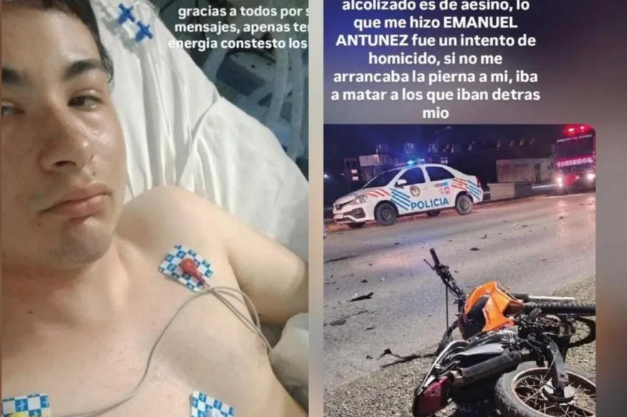 Motociclista herido/ Amputación de pierna