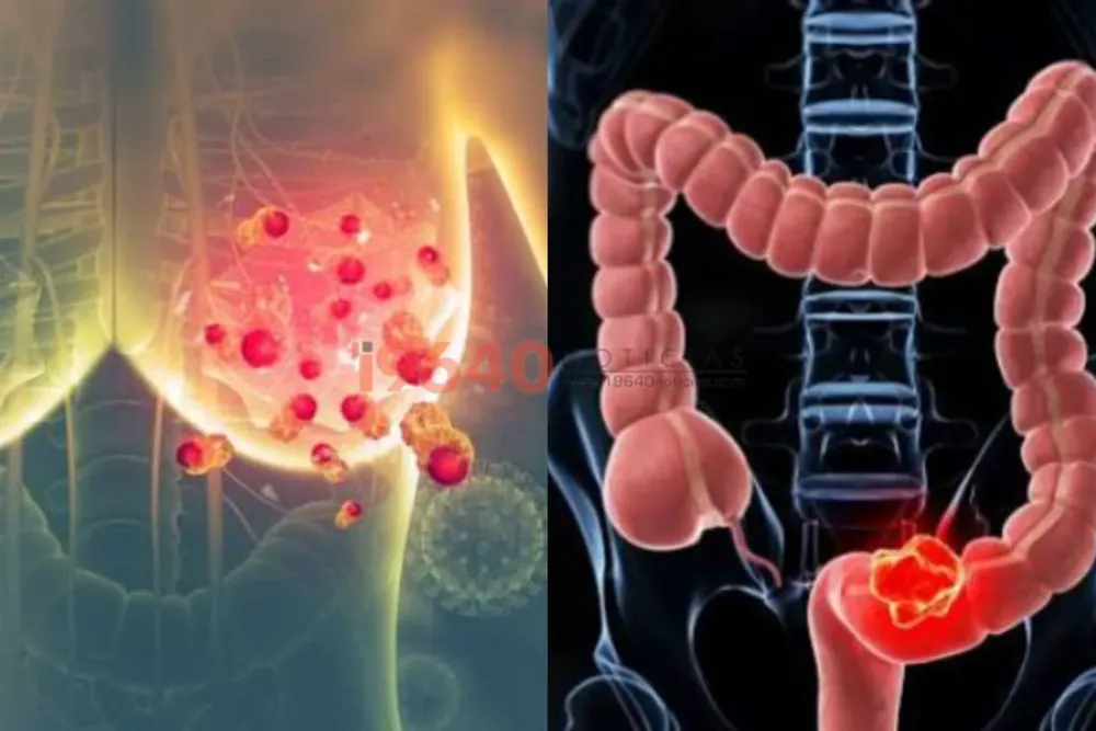 Cáncer